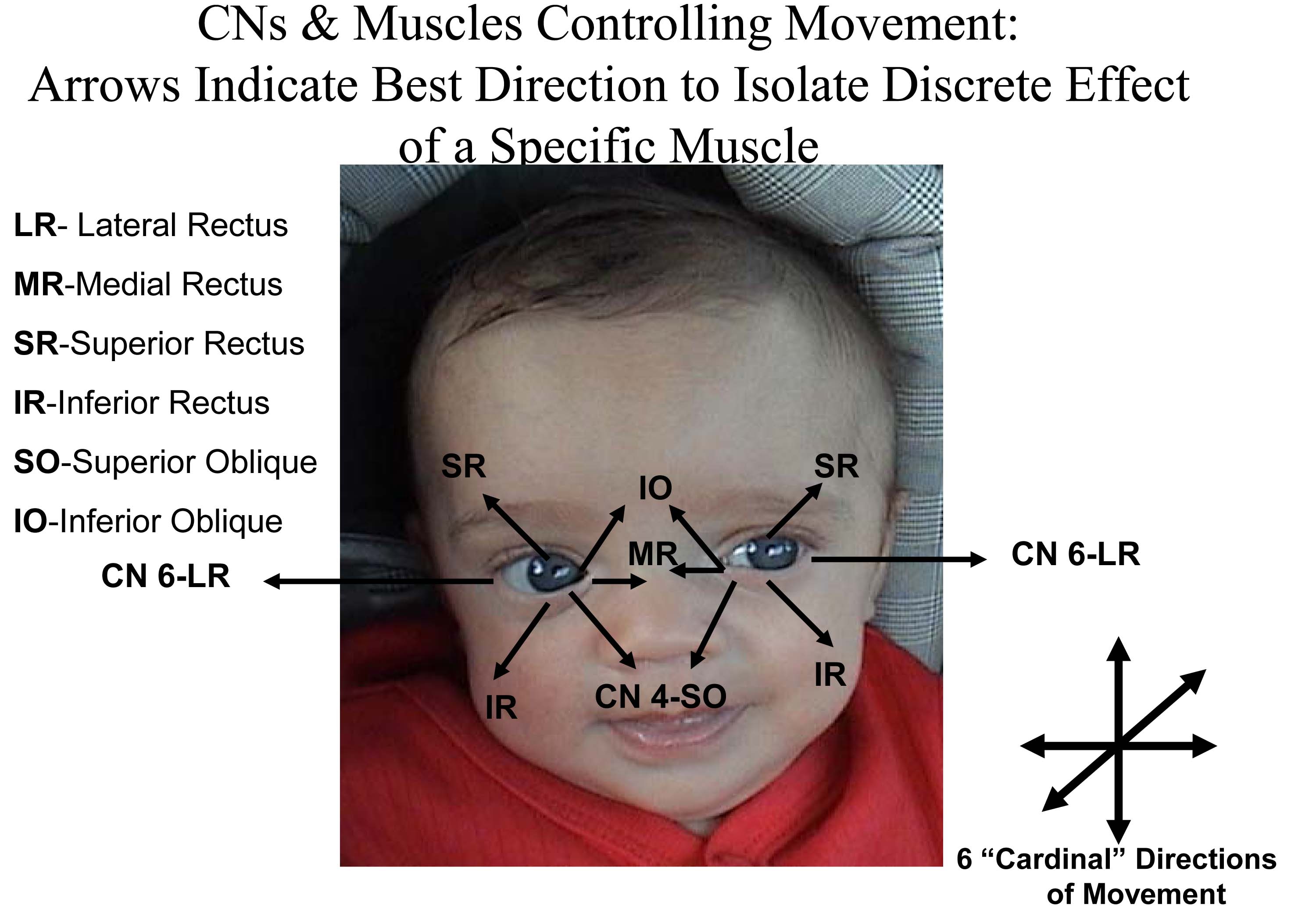 CN and Muscles Eye