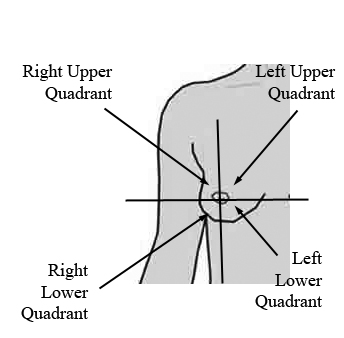 Adipose Tissue of Breast (Inferior Medial Quadrant; Right)