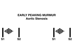 Early peaking murmur