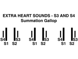 Heart sounds summation gallop