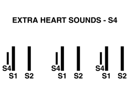 Heart sounds S4