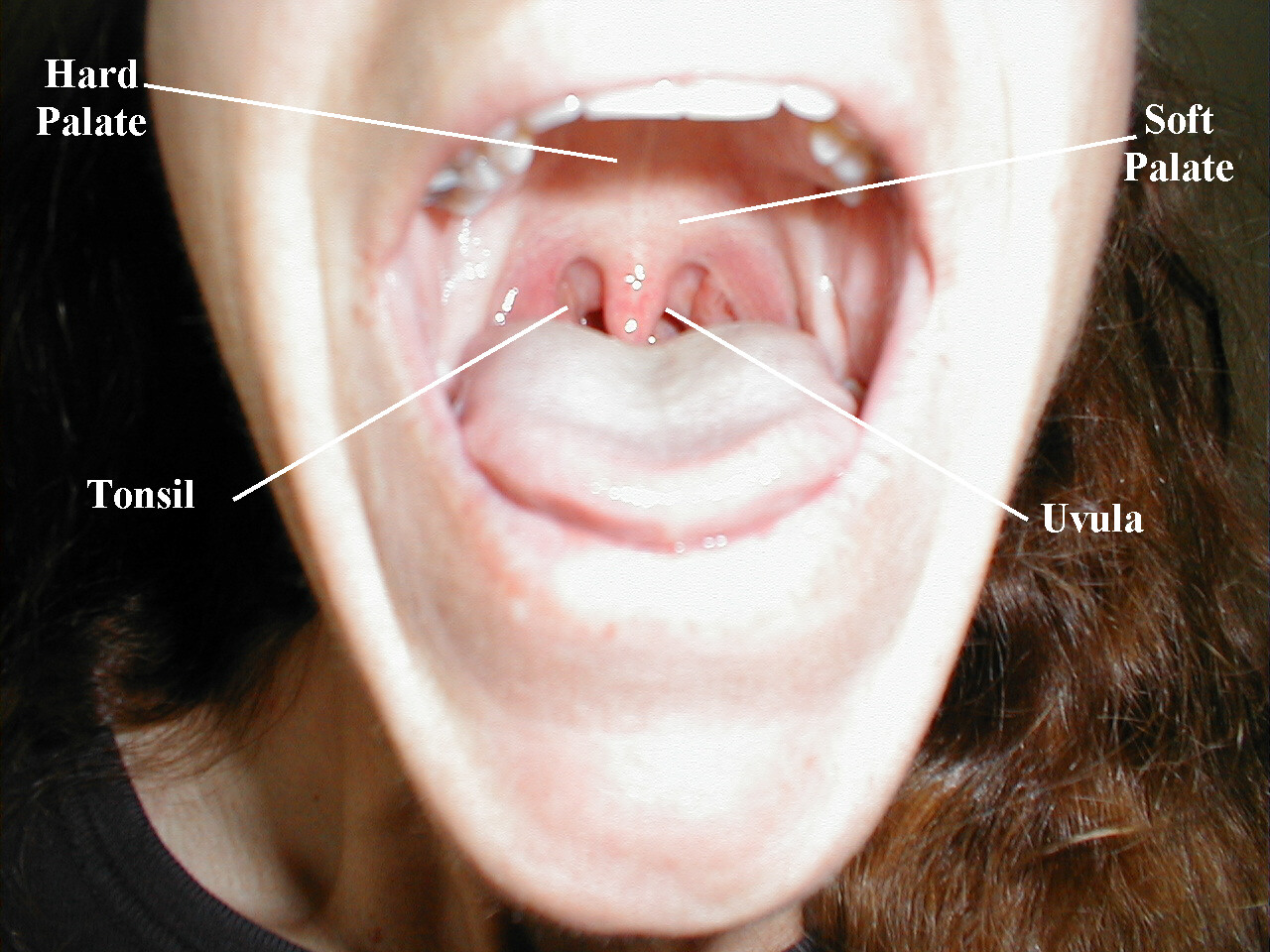 normal mouth
