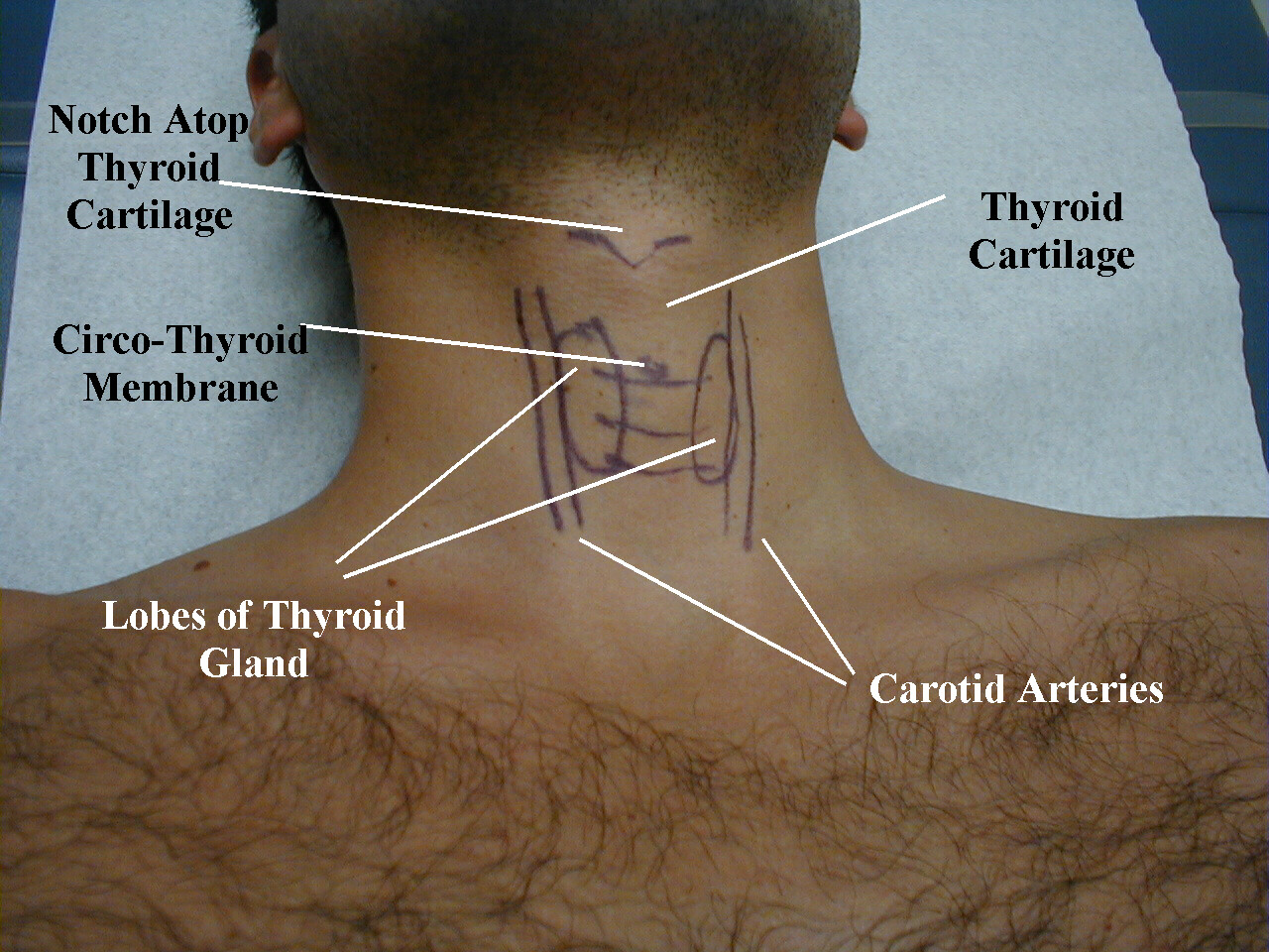thyroid anatomy