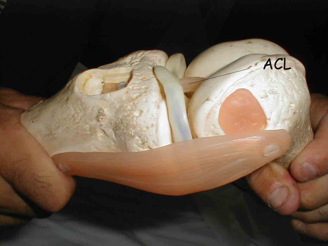 Stressing the ACL Model