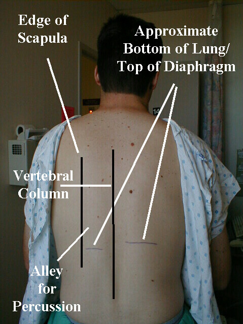 lungs-posterior