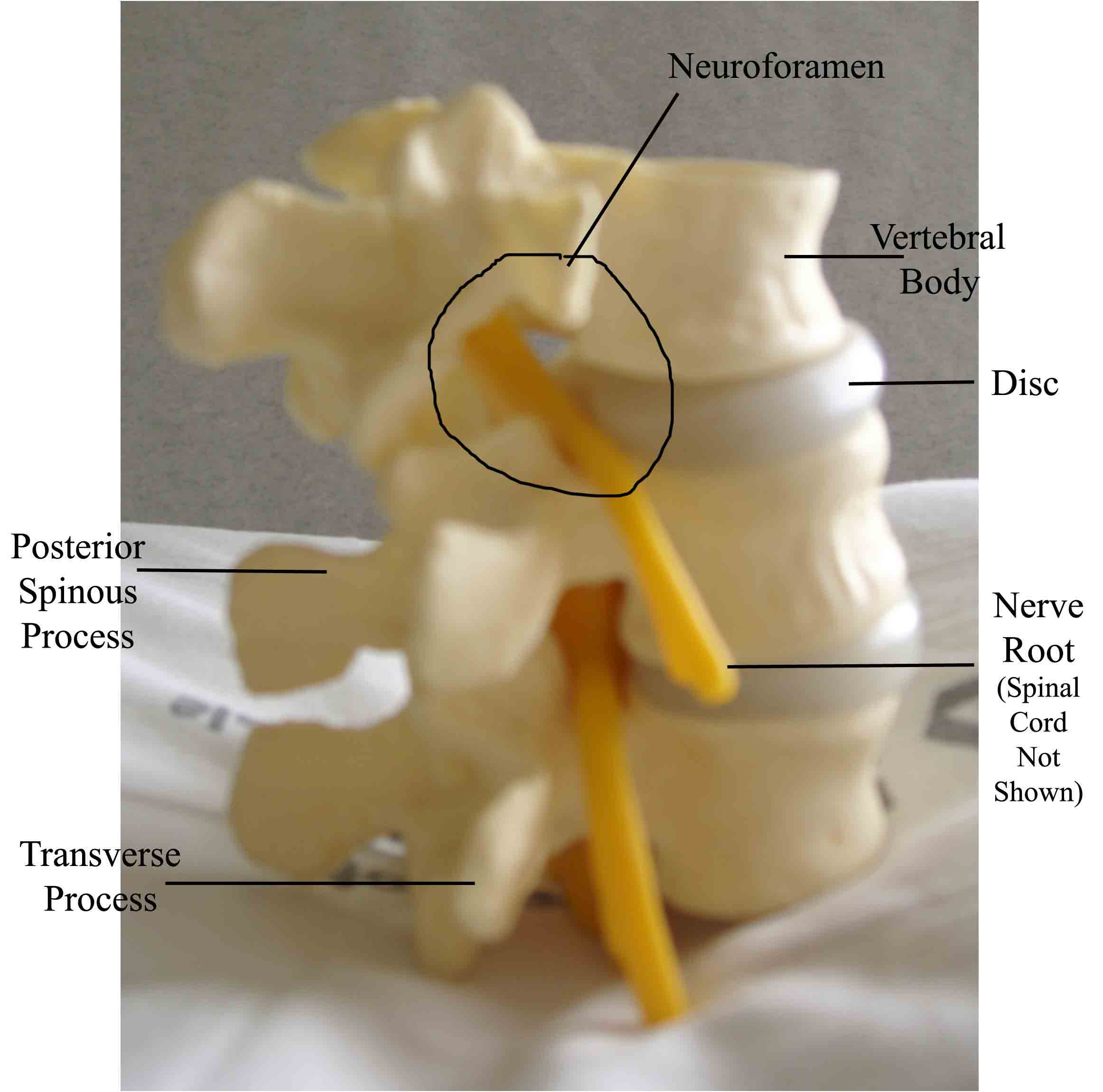 Anatomy of the Lumbar Spine - Lateral