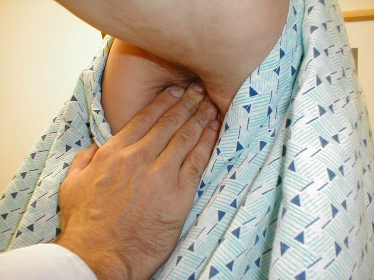 Pendulous breast in supine position without microshell immobilization.