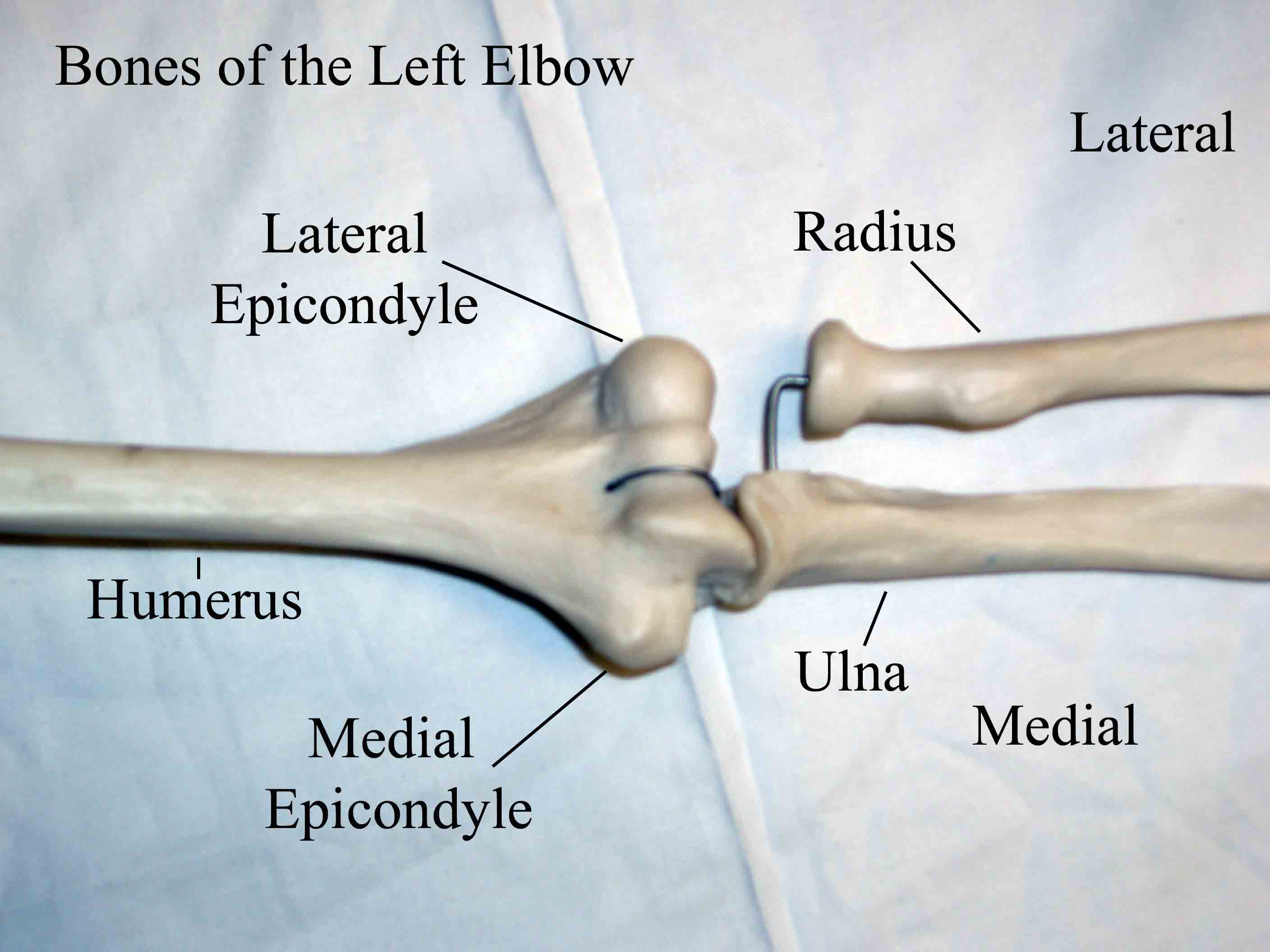 Elbow bones