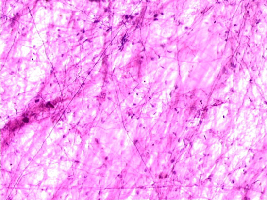 areolar loose connective tissue