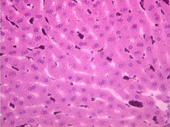 Risultati immagini per macrophages liver