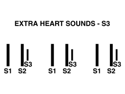 Heart sounds S3